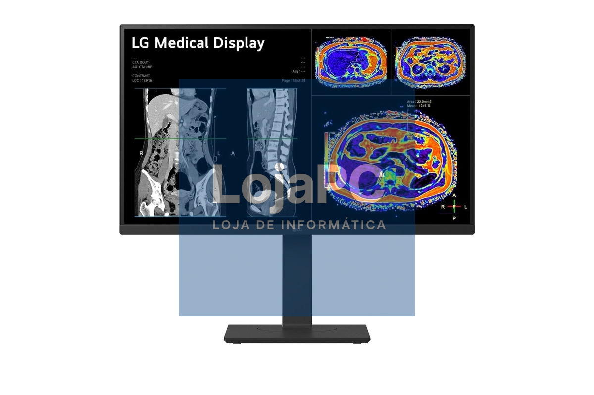 LG 27inch 8MP IPS 27HS713C-B.AEU CLINICAL REVIEW MONITOR